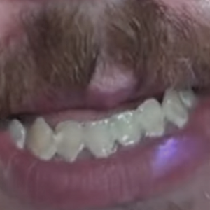 gebiss.png